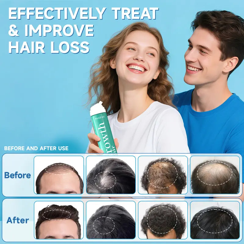 PHOFAY Men's 5% Minoxidil Foam for Hair Regrowth, 2 Month Supply